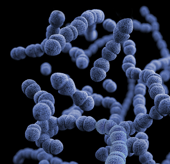contaminacion-curzada-cocina bacterias-higiene-cocinas-profesionales